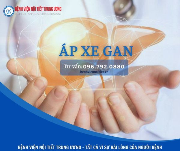 NGƯỜI ĐÀN ÔNG BỊ ÁP XE GAN DO BIẾN CHỨNG ĐÁI THÁO ĐƯỜNG