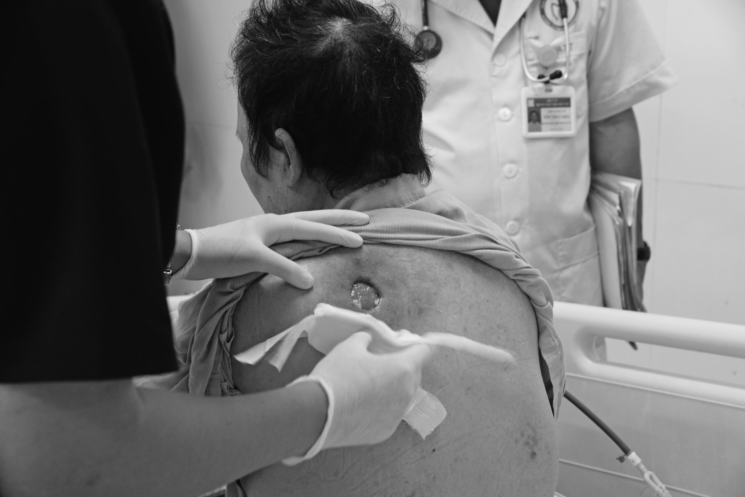 Bệnh nhân đái tháo đường nguy kịch vì uống nước đường “giải độc” theo thầy lang