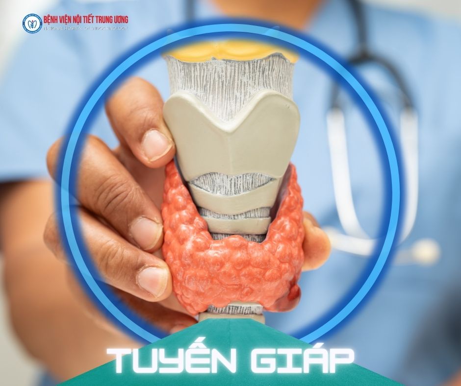 Điều trị bệnh tuyến giáp: Lựa chọn phương pháp phù hợp cho từng người bệnh