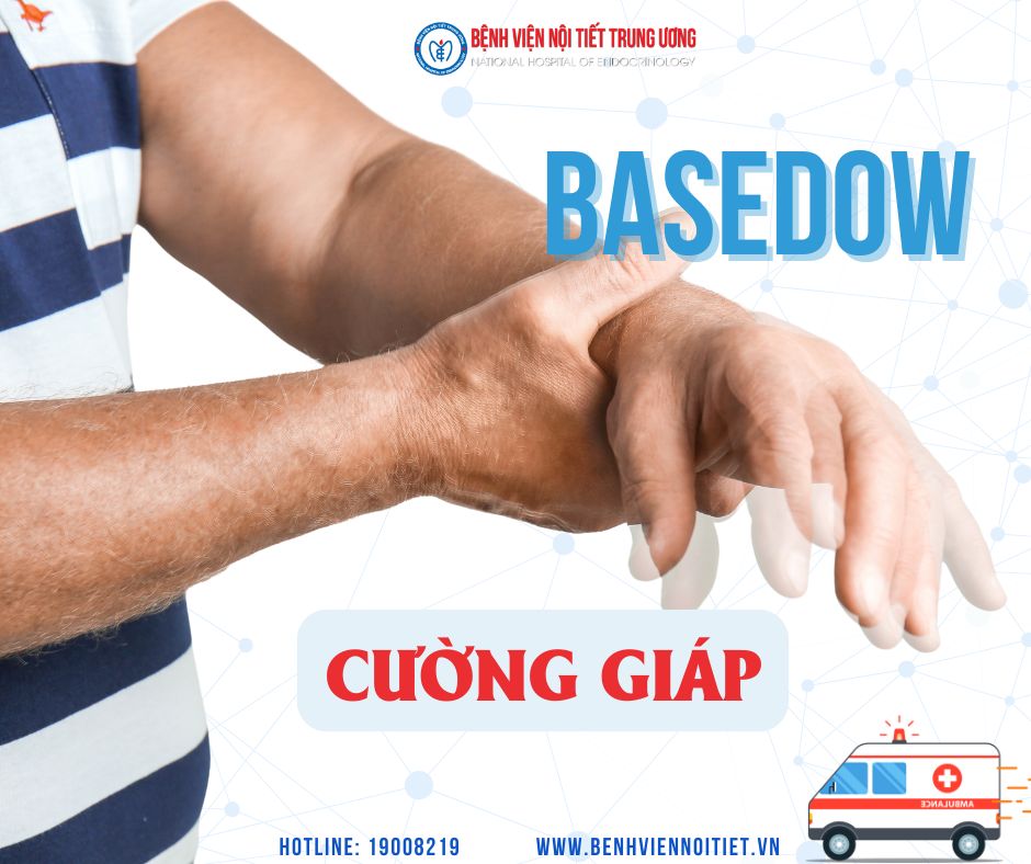 Basedow – Bệnh cường giáp âm thầm nhưng không hề hiếm gặp