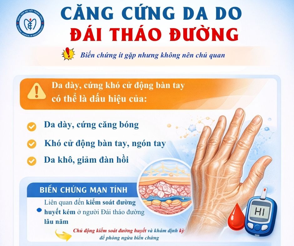 Căng cứng da do đái tháo đường: Biến chứng mạn tính âm thầm nhưng nguy hiểm