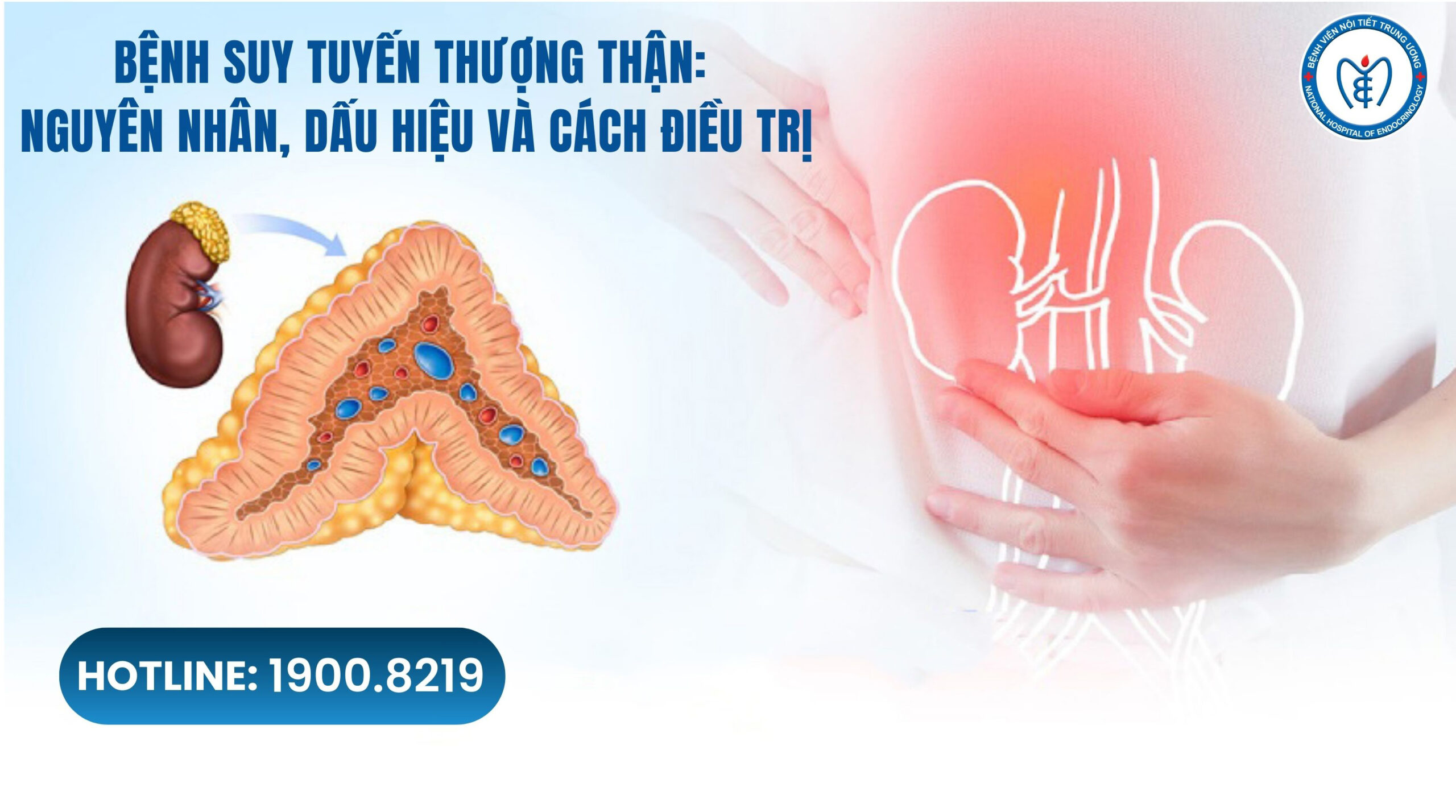 Suy tuyến thượng thận: Nguyên nhân, dấu hiệu và cách điều trị