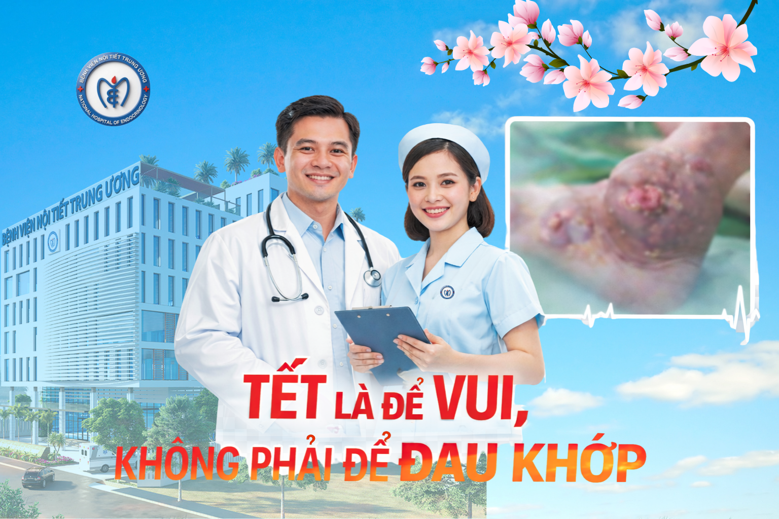 Tết là để vui , không phải để đau khớp