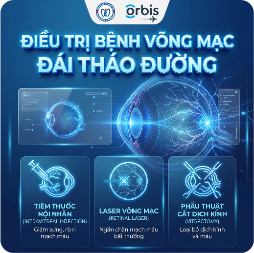 Điều trị bệnh võng mạc đái tháo đường: Những phương pháp hiện nay