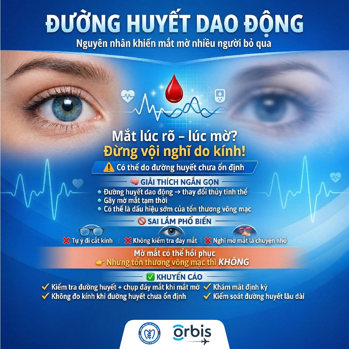 Đường huyết dao động – Nguyên nhân khiến mắt mờ mà nhiều người bỏ qua