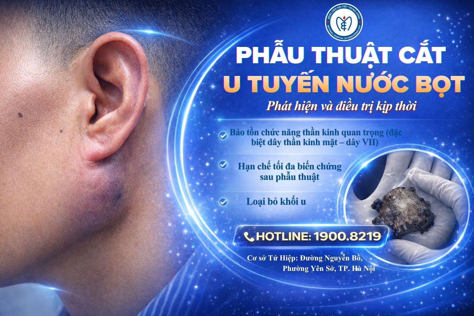 Người đàn ông có khối u to nhanh bất thường dưới tai – gây mất thẩm mỹ vùng mặt, ăn nhai khó chịu