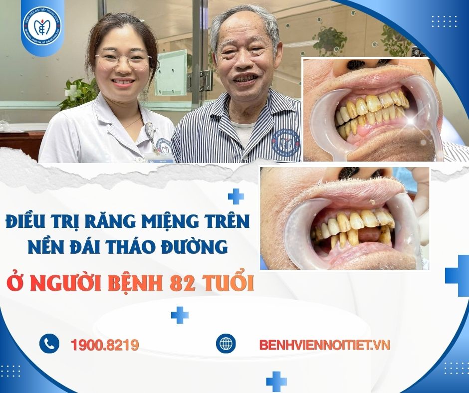 Người bệnh 82 tuổi phục hồi chức năng ăn nhai sau điều trị răng miệng trên nền đái tháo đường