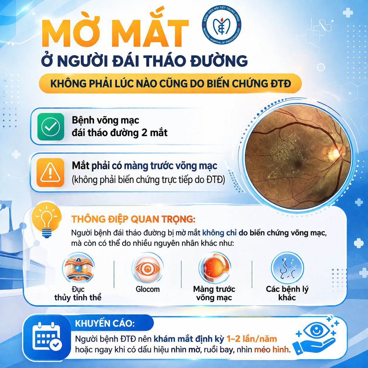 Mờ mắt ở người đái tháo đường – không phải lúc nào cũng do biến chứng võng mạc