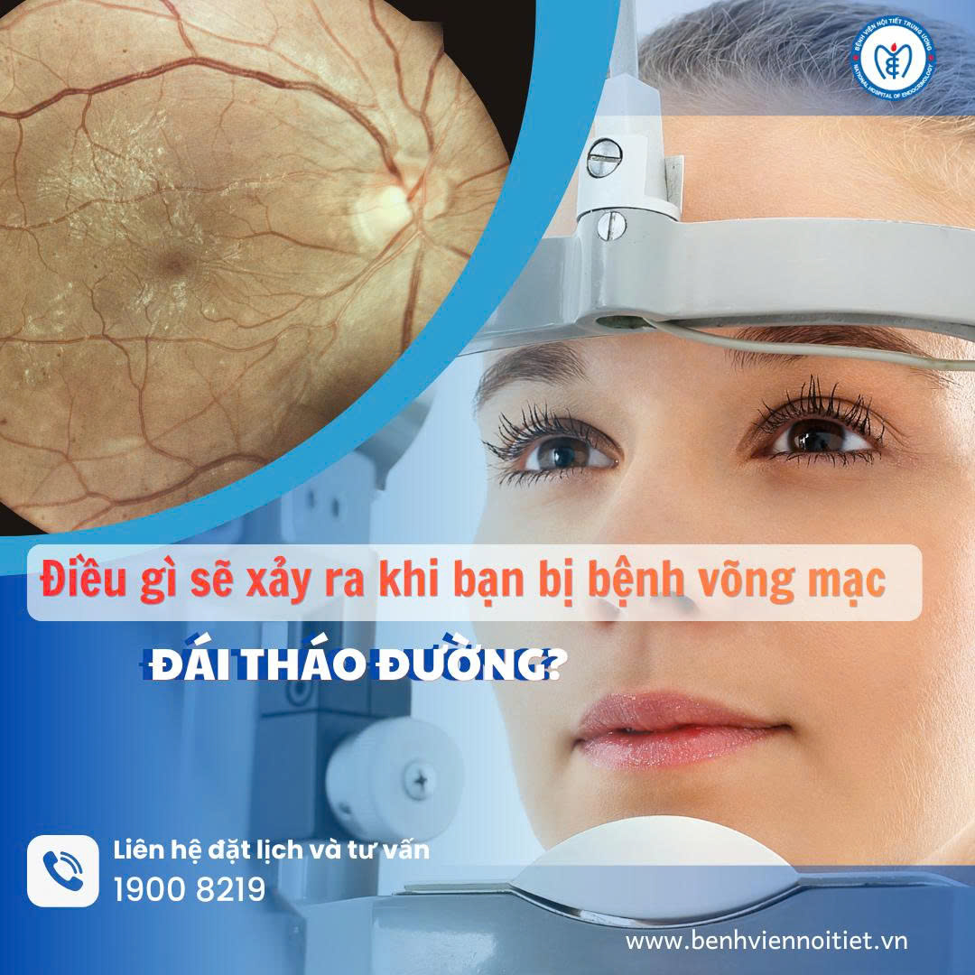 Bệnh võng mạc đái tháo đường có thể gây ra điều gì?