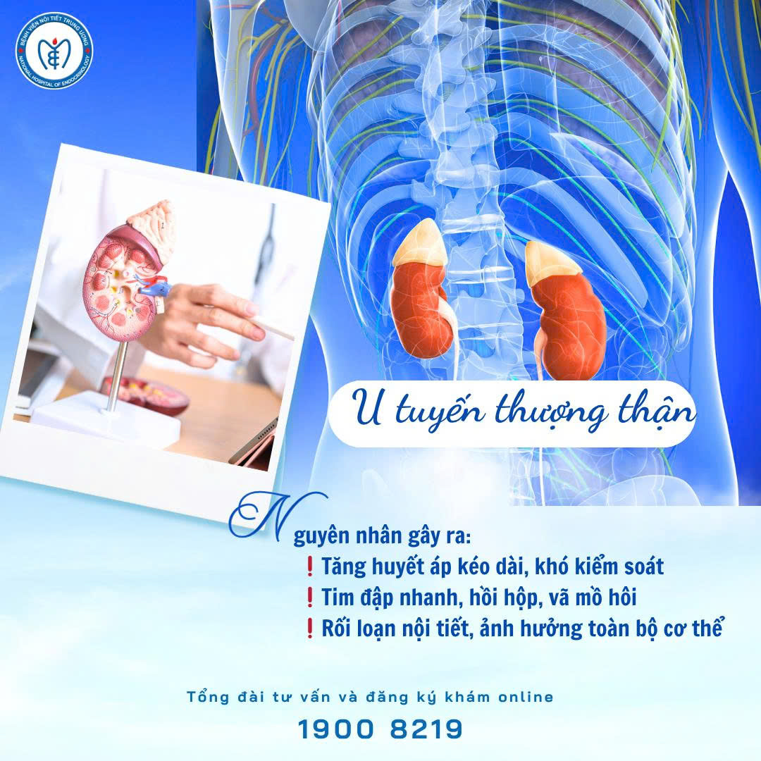 U tuyến thượng thận – Khối u nhỏ nhưng hậu quả “khôn lường”