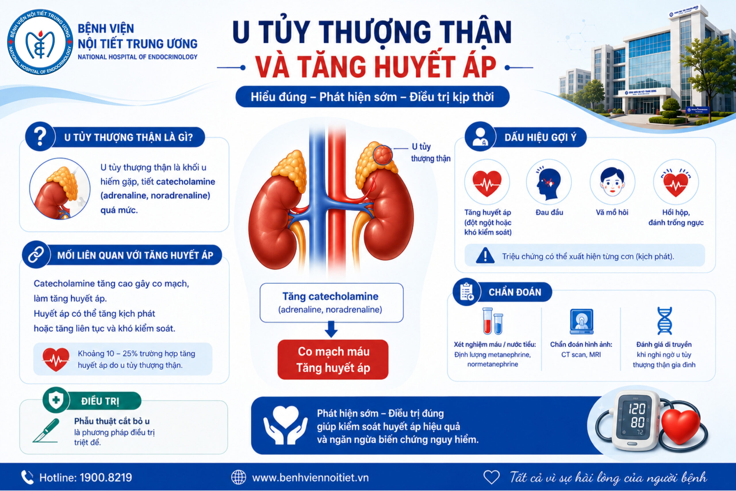 Cảnh báo u tủy thượng thận – nguyên nhân nguy hiểm gây tăng huyết áp ít người biết đến