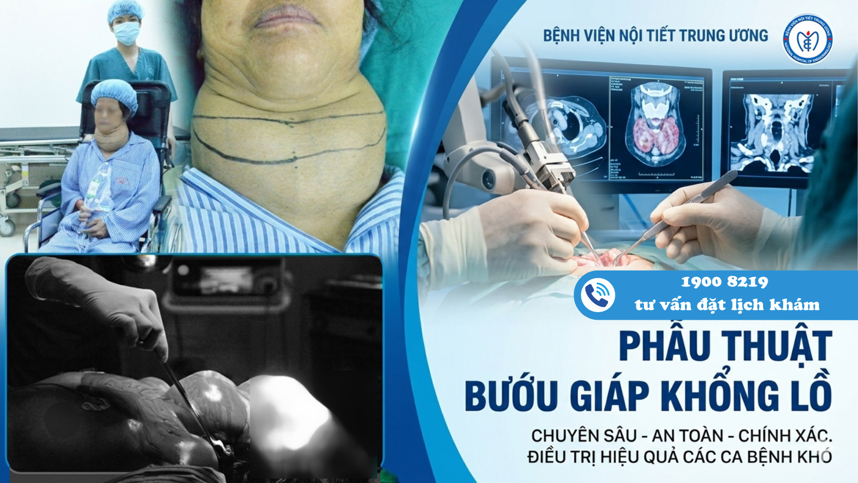 Bướu giáp to khổng lồ – Đừng chủ quan khi khối u ngày càng phát triển