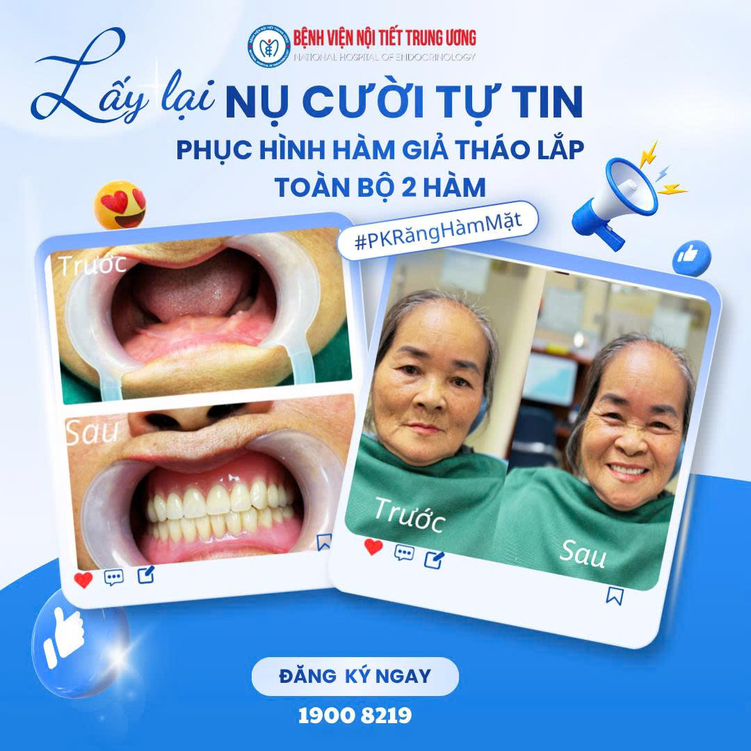 Lấy lại nụ cười tự tin cho bệnh nhân mất răng toàn bộ hai hàm