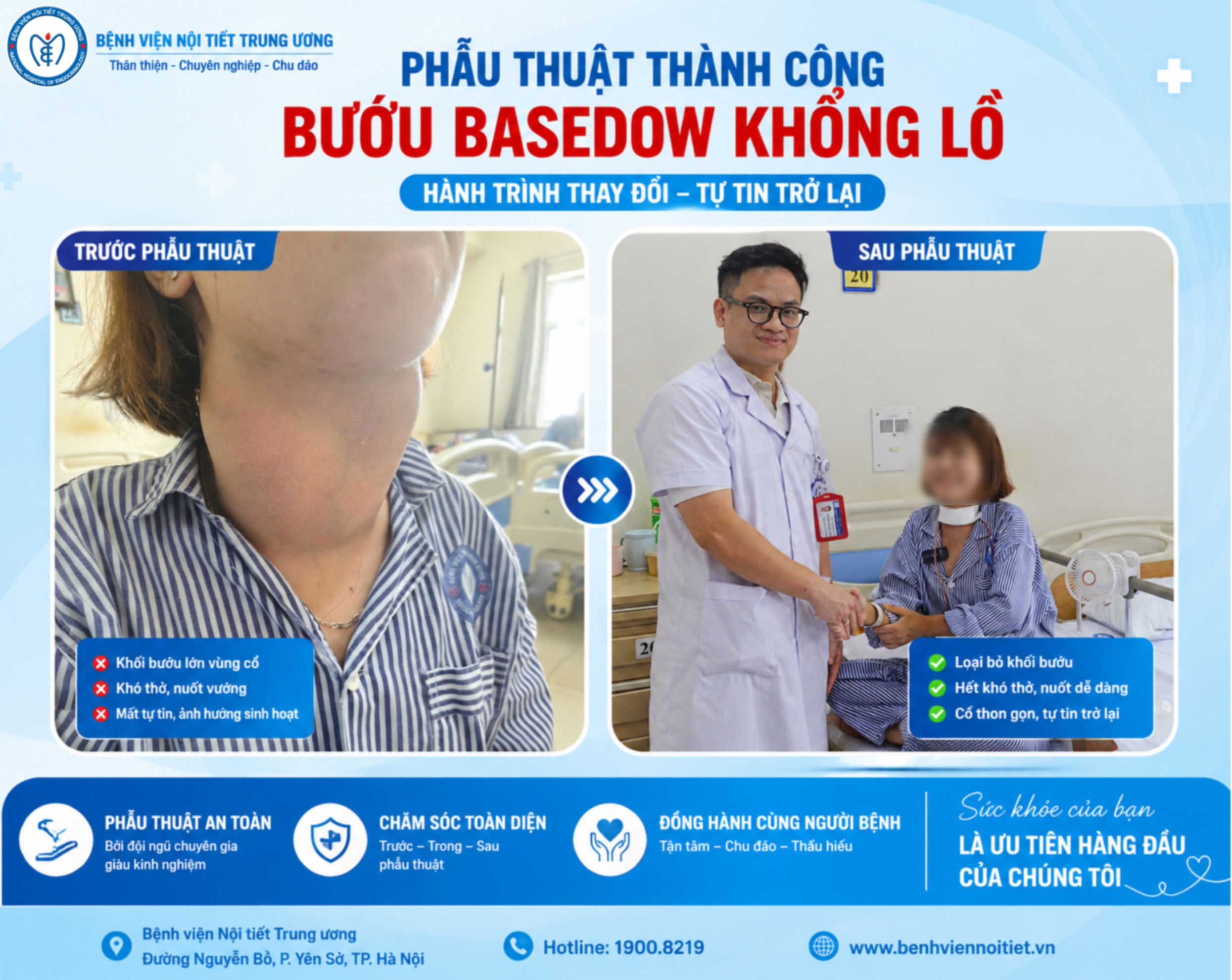 PHẪU THUẬT ĐIỀU TRỊ THÀNH CÔNG CA BỆNH BASEDOW BƯỚU GIÁP KHỔNG LỒ – HÀNH TRÌNH LẤY LẠI SỰ TỰ TIN